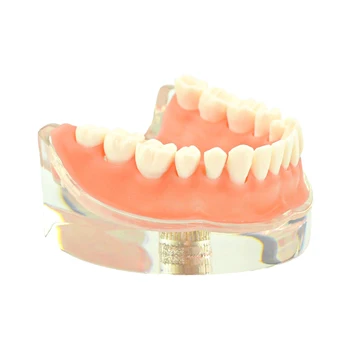 Модел зъби, възстановяване на импланти, модел на зъбите, зъбни импланти, модел на зъбите, зъболекарски инструмент